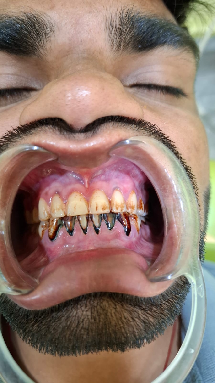 Patient Transformation 3